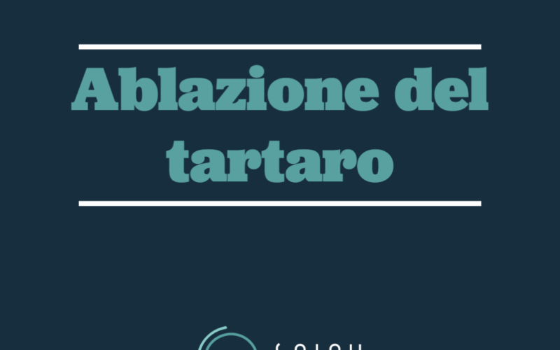 Ablazione del tartaro